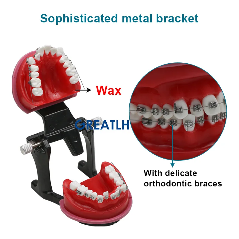 Fogászati fogszabályozó praxis modell fém konzolokkal Vörös viaszgumi fogfog fogászati kellékek fogászati eszköz