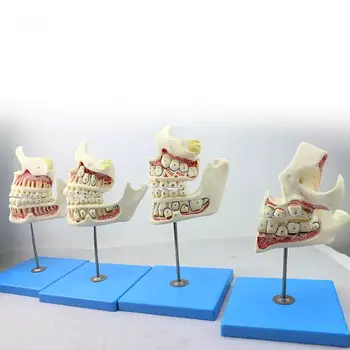 Az emberi fejlődés szakaszának beállítása a lombhullatótól az állandó fogakig Szájüreg Fogorvos Fogorvos Modell Orvosi Iskola